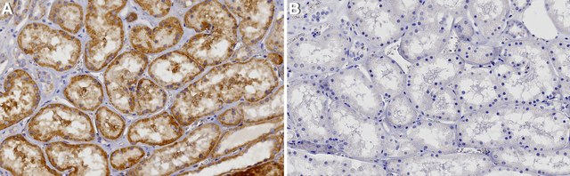 Anti-FRS2/SNT-1 Antibody, clone 1C19 ZooMAb&#174; Rabbit Monoclonal recombinant, expressed in HEK 293 cells