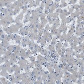 Anti-PTPRT antibody produced in rabbit Prestige Antibodies® Powered by Atlas Antibodies, affinity isolated antibody, buffered aqueous glycerol solution