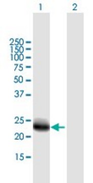 Anti-DNAJC5B antibody produced in mouse purified immunoglobulin, buffered aqueous solution