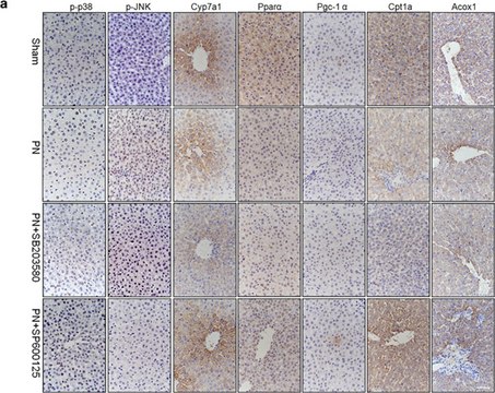 Anti-Cyp7a1 Antibody, clone 15B9.1 clone 15B9.1, from mouse