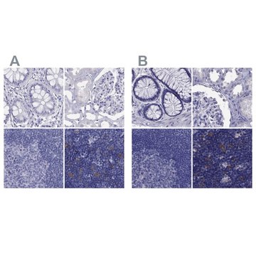 Anti-PSMB11 antibody produced in rabbit Prestige Antibodies&#174; Powered by Atlas Antibodies, affinity isolated antibody, buffered aqueous glycerol solution