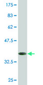 Monoclonal Anti-HOXD1 antibody produced in mouse clone 4F4, purified immunoglobulin, buffered aqueous solution