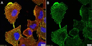 Anti-α-Actinin 4 Antibody, clone 1D9 ZooMAb® Rabbit Monoclonal recombinant, expressed in HEK 293 cells