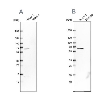 Anti-NMT1 antibody produced in rabbit Prestige Antibodies&#174; Powered by Atlas Antibodies, affinity isolated antibody, buffered aqueous glycerol solution, Ab1