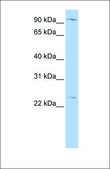 Anti-OSBPL8 antibody produced in rabbit affinity isolated antibody