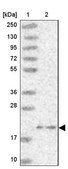 Anti-ARL8A antibody produced in rabbit Prestige Antibodies® Powered by Atlas Antibodies, affinity isolated antibody, buffered aqueous glycerol solution