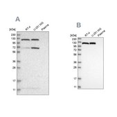 Anti-ACLY antibody produced in rabbit Prestige Antibodies® Powered by Atlas Antibodies, affinity isolated antibody, buffered aqueous glycerol solution