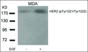 Anti-phospho-ERBB2 (pTyr1221/pTyr1222) antibody produced in rabbit affinity isolated antibody
