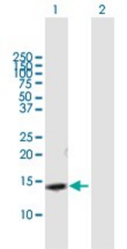 Anti-SLPI antibody produced in mouse purified immunoglobulin, buffered aqueous solution