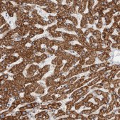 Anti-ECHDC2 antibody produced in rabbit Prestige Antibodies® Powered by Atlas Antibodies, affinity isolated antibody, buffered aqueous glycerol solution, Ab2