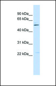 Anti-TRIM35 antibody produced in rabbit affinity isolated antibody