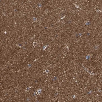 Anti-LRSAM1 antibody produced in rabbit Prestige Antibodies&#174; Powered by Atlas Antibodies, affinity isolated antibody, buffered aqueous glycerol solution, Ab2