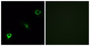 Anti-TYK2 antibody produced in rabbit affinity isolated antibody