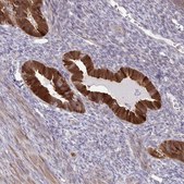 Anti-CMPK1 antibody produced in rabbit Prestige Antibodies® Powered by Atlas Antibodies, affinity isolated antibody, buffered aqueous glycerol solution