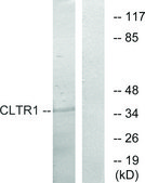 Anti-CLTR1 antibody produced in rabbit affinity isolated antibody
