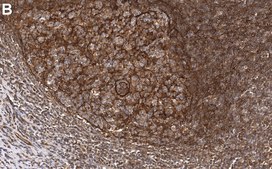 Anti-OAS1 Antibody, clone 1N2 ZooMAb® Rabbit Monoclonal recombinant, expressed in HEK 293 cells