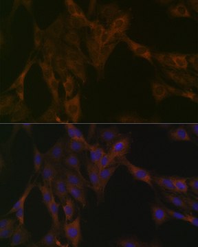 Anti-DDX6 Antibody, clone 6F9I6, Rabbit Monoclonal