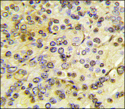 Anti-MEN1 (T594) antibody produced in rabbit IgG fraction of antiserum, buffered aqueous solution