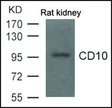 Anti-CD10 antibody produced in rabbit affinity isolated antibody