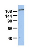 Anti-SIN3B (AB1) antibody produced in rabbit affinity isolated antibody