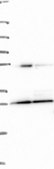 Anti-EIF4E2 antibody produced in rabbit Prestige Antibodies® Powered by Atlas Antibodies, affinity isolated antibody, buffered aqueous glycerol solution