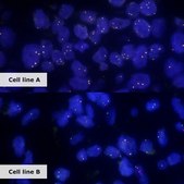ALK-Lung Analyte Control Cell line controls for immunohistochemistry and in situ hybridization