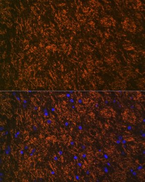 Anti-Myelin oligodendrocyte glycoprotein antibody produced in rabbit