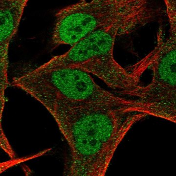 Anti-NMRK2 antibody produced in rabbit Prestige Antibodies&#174; Powered by Atlas Antibodies, affinity isolated antibody