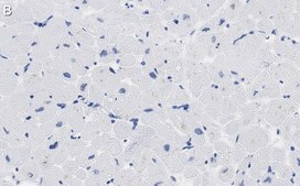 Anti-PDK4 Antibody, clone 2H5 ZooMAb® Rabbit Monoclonal recombinant, expressed in HEK 293 cells