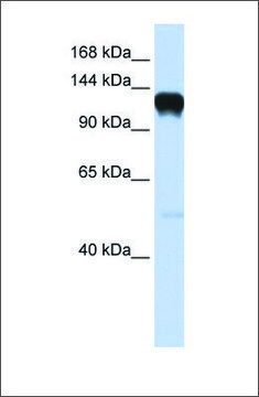 Anti-EPHA5 antibody produced in rabbit affinity isolated antibody