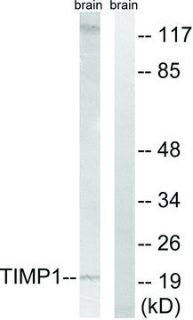 Anti-TIMP1 antibody produced in rabbit affinity isolated antibody