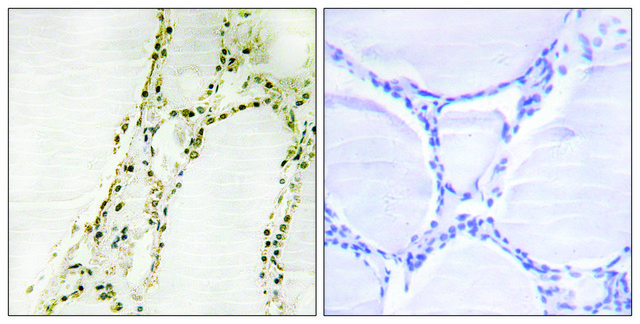 Anti-S6K-&#945;2 antibody produced in rabbit affinity isolated antibody