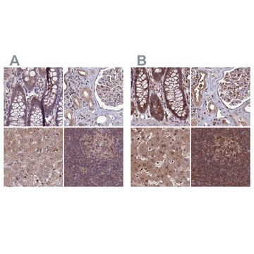 Anti-PSMB8 antibody produced in rabbit Prestige Antibodies&#174; Powered by Atlas Antibodies, affinity isolated antibody, buffered aqueous glycerol solution