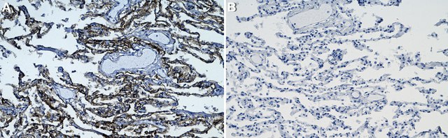 Anti-RAGE Antibody, clone 1I22 ZooMAb&#174; Rabbit Monoclonal recombinant, expressed in HEK 293 cells