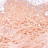 Anti-AKT1 antibody produced in rabbit