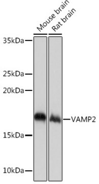 Anti-VAMP2 Antibody, clone 8X9D9, Rabbit Monoclonal