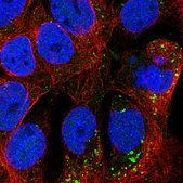 Anti-TMEM182 antibody produced in rabbit Prestige Antibodies® Powered by Atlas Antibodies, affinity isolated antibody, buffered aqueous glycerol solution