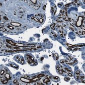 Anti-ZDHHC6 antibody produced in rabbit Prestige Antibodies® Powered by Atlas Antibodies, affinity isolated antibody, buffered aqueous glycerol solution