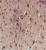 Anti-Tau (4-repeat isoform RD4) Antibody, clone 7D12.1 clone 7D12.1, from mouse