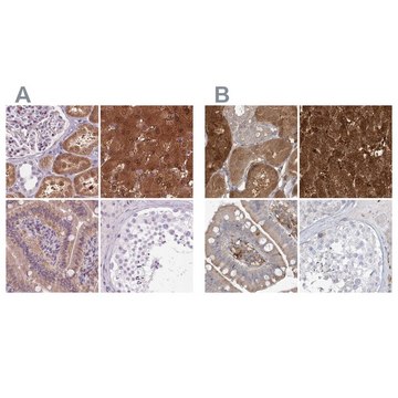 Anti-HAAO antibody produced in rabbit Prestige Antibodies&#174; Powered by Atlas Antibodies, affinity isolated antibody, buffered aqueous glycerol solution