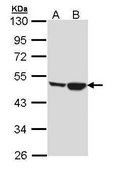 Anti-CKMT1A antibody produced in rabbit affinity isolated antibody, buffered aqueous solution