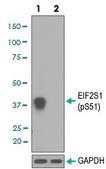 Monoclonal Anti-EIF2S1 (phospho S51) antibody produced in rabbit clone IO-5