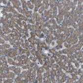 Anti-SGK2 antibody produced in rabbit Prestige Antibodies® Powered by Atlas Antibodies, affinity isolated antibody, buffered aqueous glycerol solution