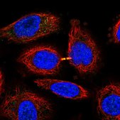抗-SLFN13 兔抗 Prestige Antibodies® Powered by Atlas Antibodies, affinity isolated antibody, buffered aqueous glycerol solution, Ab1