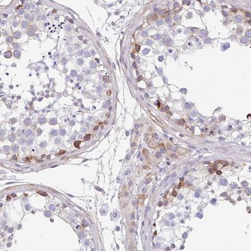 Anti-FBXL20 antibody produced in rabbit Prestige Antibodies&#174; Powered by Atlas Antibodies, affinity isolated antibody, buffered aqueous glycerol solution