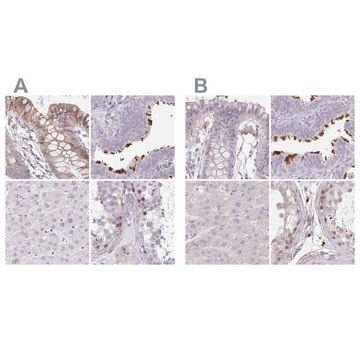 Anti-TMEM237 antibody produced in rabbit Prestige Antibodies&#174; Powered by Atlas Antibodies, affinity isolated antibody, buffered aqueous glycerol solution