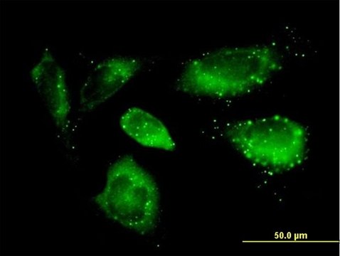 Anti-SQSTM1 antibody produced in mouse purified immunoglobulin, buffered aqueous solution