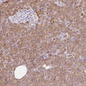 Anti-CPB1 antibody produced in rabbit Prestige Antibodies® Powered by Atlas Antibodies, affinity isolated antibody, buffered aqueous glycerol solution