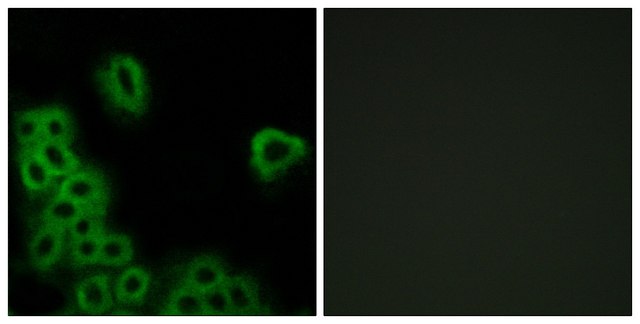 Anti-PE2R4 antibody produced in rabbit affinity isolated antibody