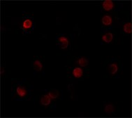 Anti-ZNF521 antibody produced in rabbit affinity isolated antibody, buffered aqueous solution